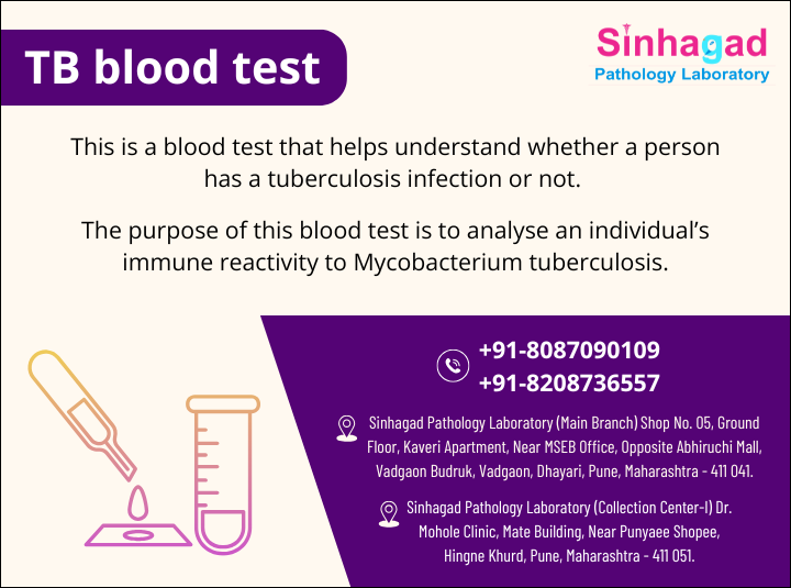 TB Blood Test