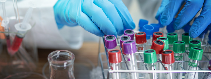 Pathology tests